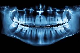 Oral Radiology